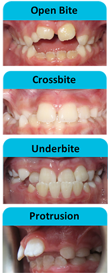 Different Types of Teeth Problems